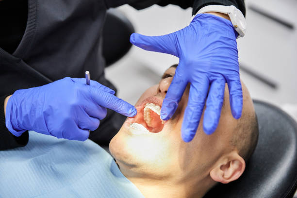 Best Urgent Care for Lost Fillings or Crowns in Imperial Beach, CA